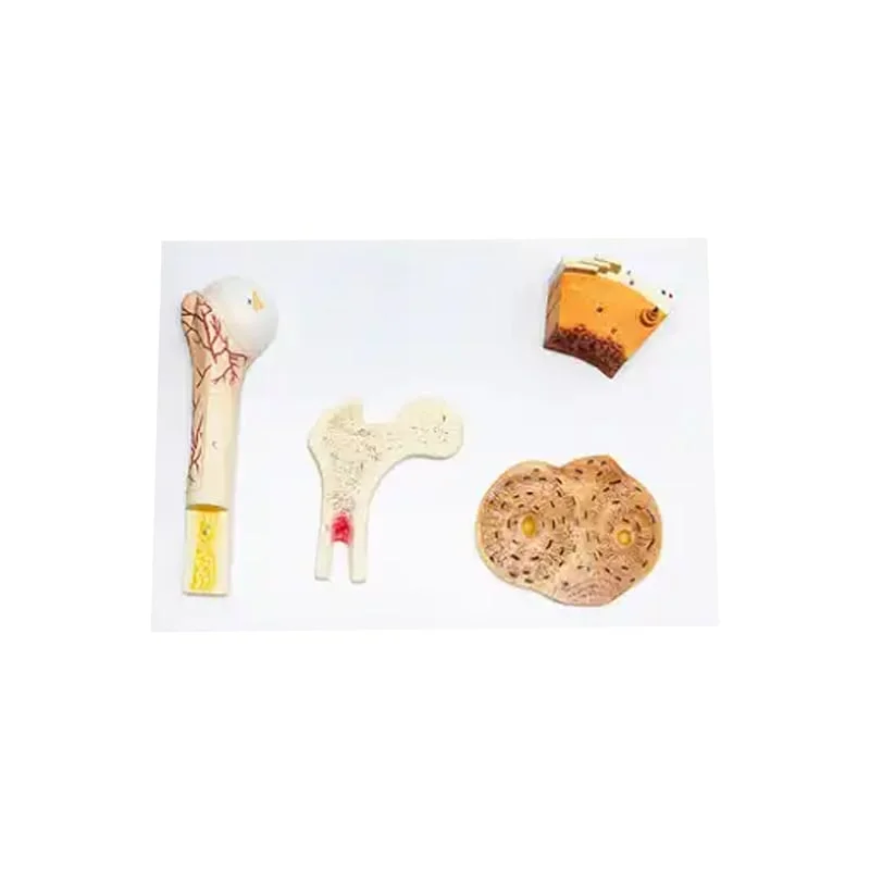 Gelsonlab Модел на костна структура